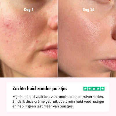 MOISTURIZER SPF50 - Glowth Skincare